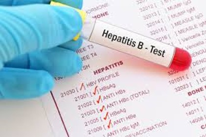 Photo of a Hepatitis B test